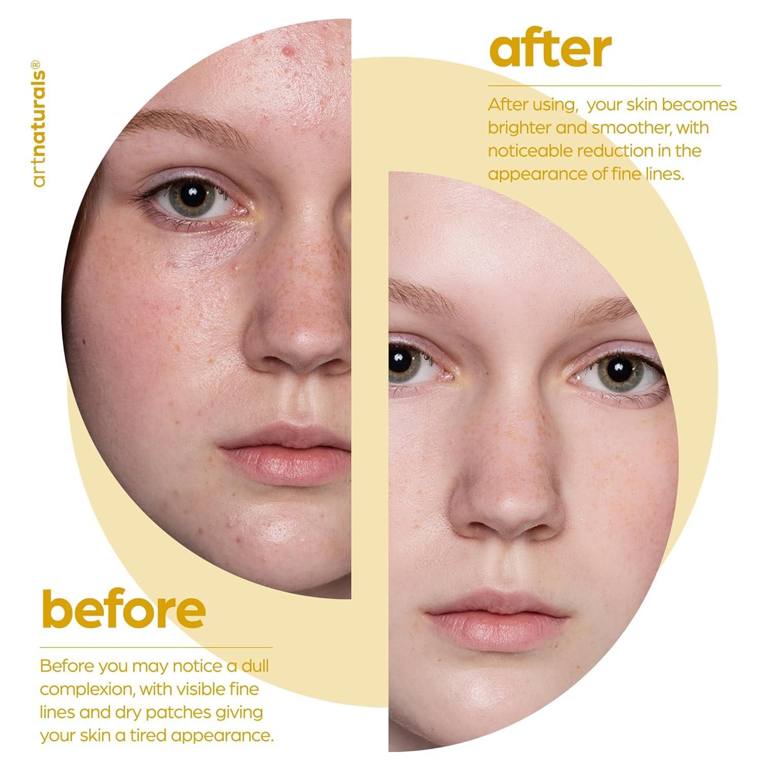 imageartnaturals Lactic Acid plus AHA Face Serum for Brightening Boost with Renewing Formula Scars Acne Wrinkles Exfoliates and Moisturizes the Skin 1 oz